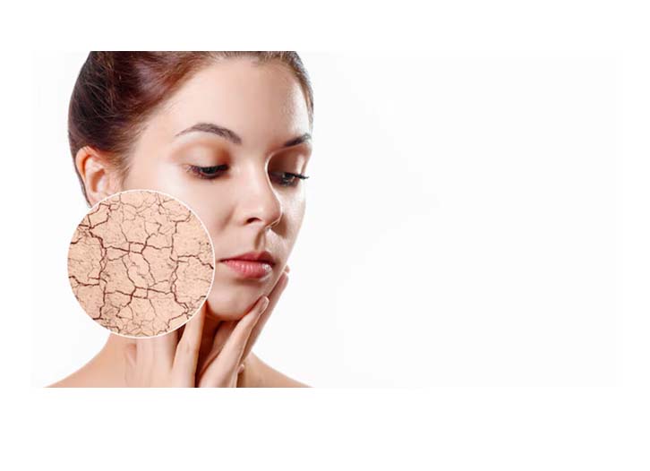 How to Treat Dehydrated Skin: A Comprehensive Guide